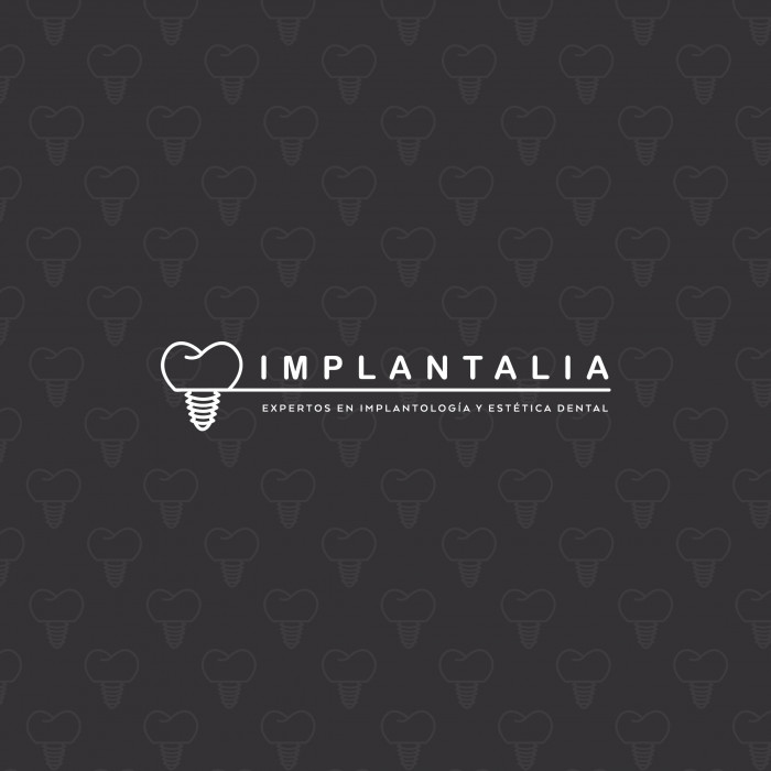 IMPLANTALIA