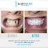 New Look Dental Cancún - Clinica Dental