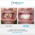 New Look Dental Cancún - Clinica Dental