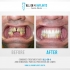 New Look Dental Cancún - Clinica Dental
